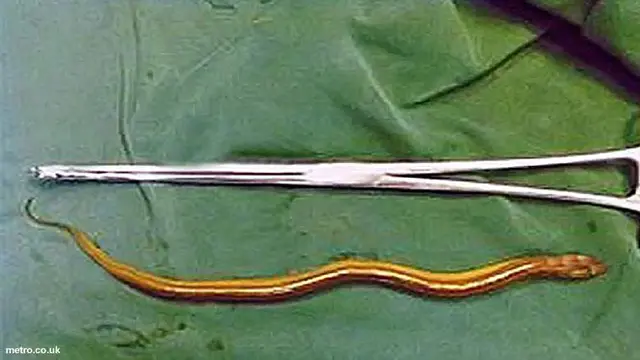 Benda Aneh 8- Belut