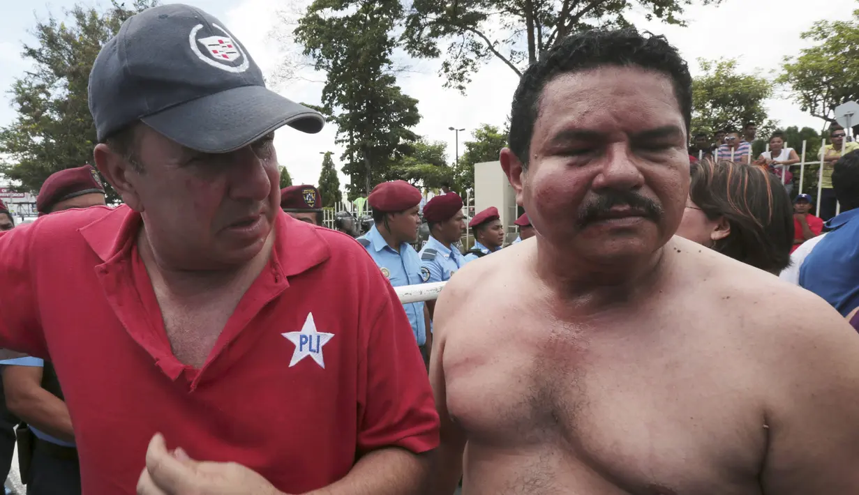 Wakil dari Independent Liberal Party (PLI), Jose Matus (kiri), dan Parlemen Amerika Tengah, Augusto Valle, cedera dalam bentrokan di depan Dewan Pemilihan Agung (CSE) Managua , Nikaragua, (8/7/ 2015). (REUTERS/Oswaldo Rivas)