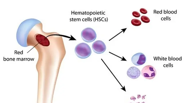Anemia Aplastik
