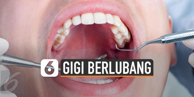 VIDEO: Hal Sepele Penyebab Gigi Berlubang