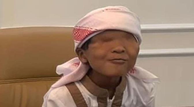 Azzam Nur Mu’jizat, bocah tanpa kelopak mata bersuara emas yang akan melantunkan sholawat asyghil pada puncak Harlah 1 Abad NU, di Sidoarjo. (Foto: NU Online)