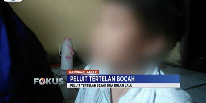 Peluit Diangkat dari Paru-Paru, Kondisi Bocah di Bandung Membaik