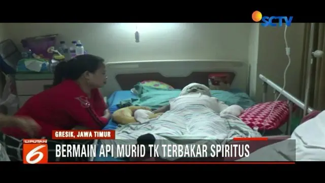 Bermain Api dan Spiritus, Bocah Ini Terbakar di Sekujur Tubuh
