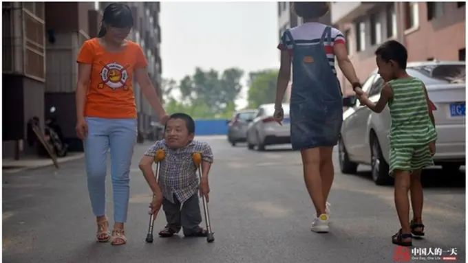 Meski Tak Memiliki Fisik Sempurna, Kami Memiliki Cinta yang Tulus