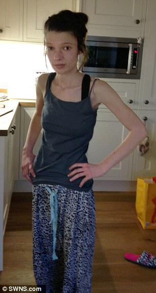 Setelah minum pil diet dan kecanduan, gadis cantik tersebut mengalami anoreksia | Photo: Copyright dailymail.co.uk