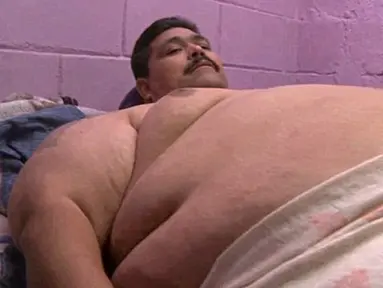 Andres Moreno (38), seorang pria yang dipercaya sebagai orang paling gemuk di dunia meninggal pada Jumat (25/12/2015) di Meksiko Utara. (Dailymail)