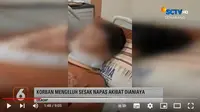 FF (13) siswa SMP korban perundungan di Cimanggu, Cilacap mengalami patah tulang rusuk. (YouTube Liputan6)