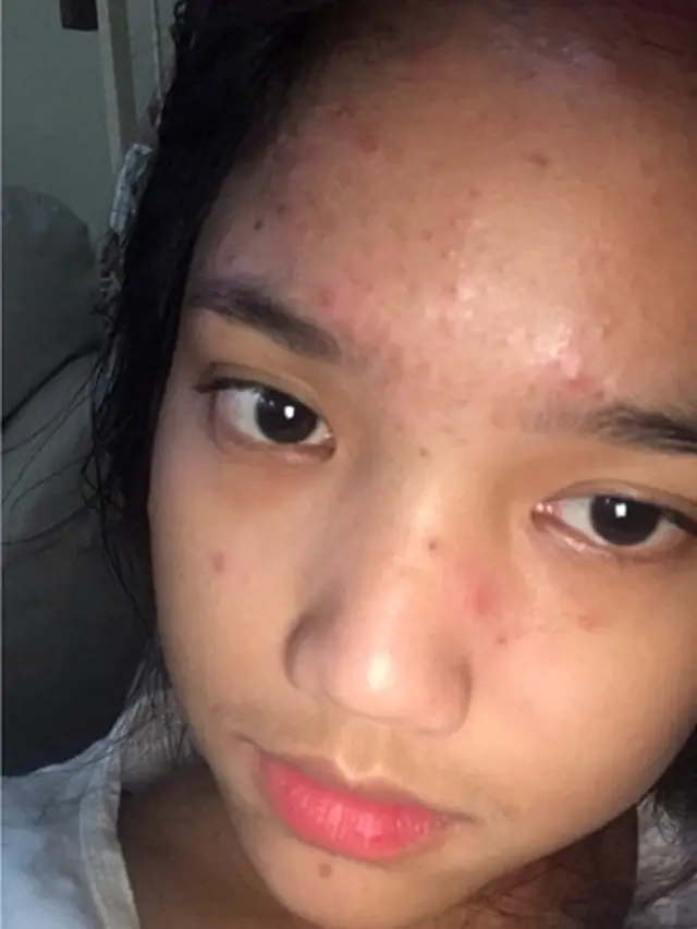 6 Potret Fuji Tanpa Makeup, Sempat Jadi Pejuang Jerawat