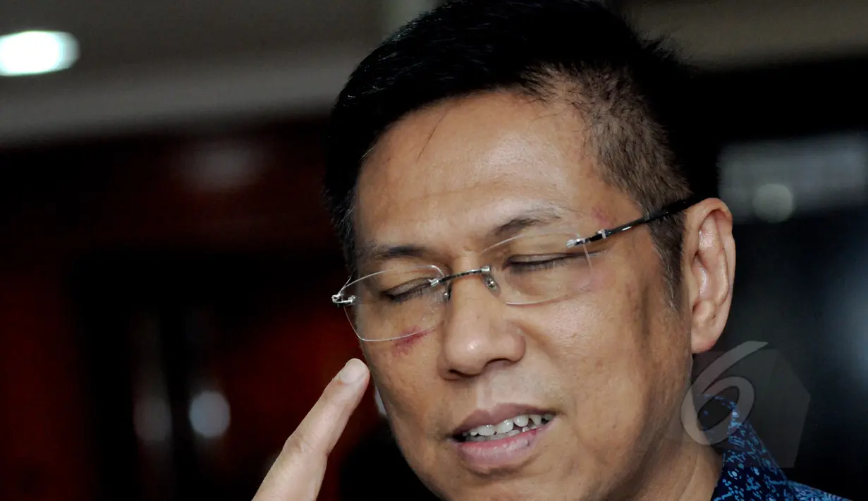 Anggota Komisi VII DPR, Mulyadi memperlihatkan luka diwajahnya usai melaporkan kasus pemukulan dirinya oleh rekannya Mustofa Assegaf kepada Ketua DPR Setya Novanto di Kompleks Parlemen, Jakarta, Kamis (9/4/2015). (Liputan6.com/Andrian M Tunay)
