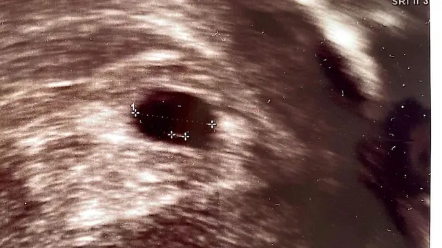 [Fimela] Annisa Pohan dan Agus Harimurti Yudhoyono