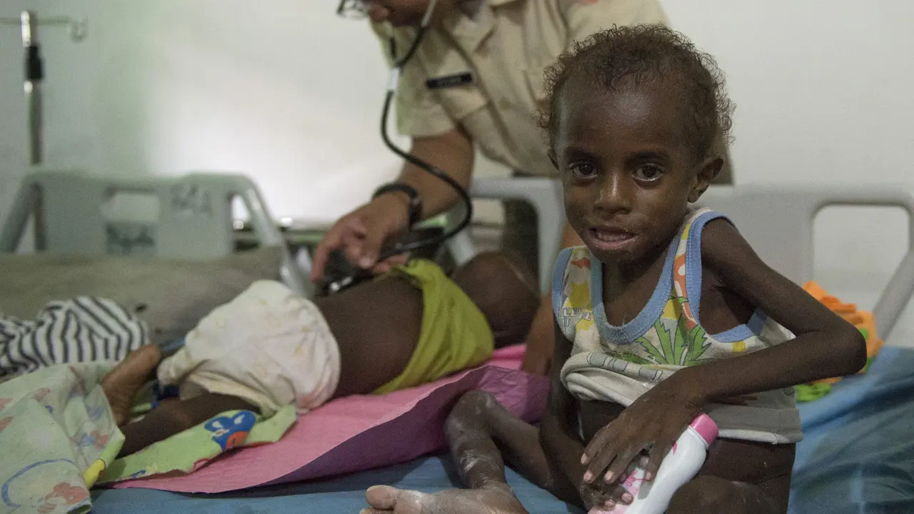 Miris, Begini Kondisi Anak-Anak Asmat yang Dilanda Gizi Buruk dan Wabah Campak