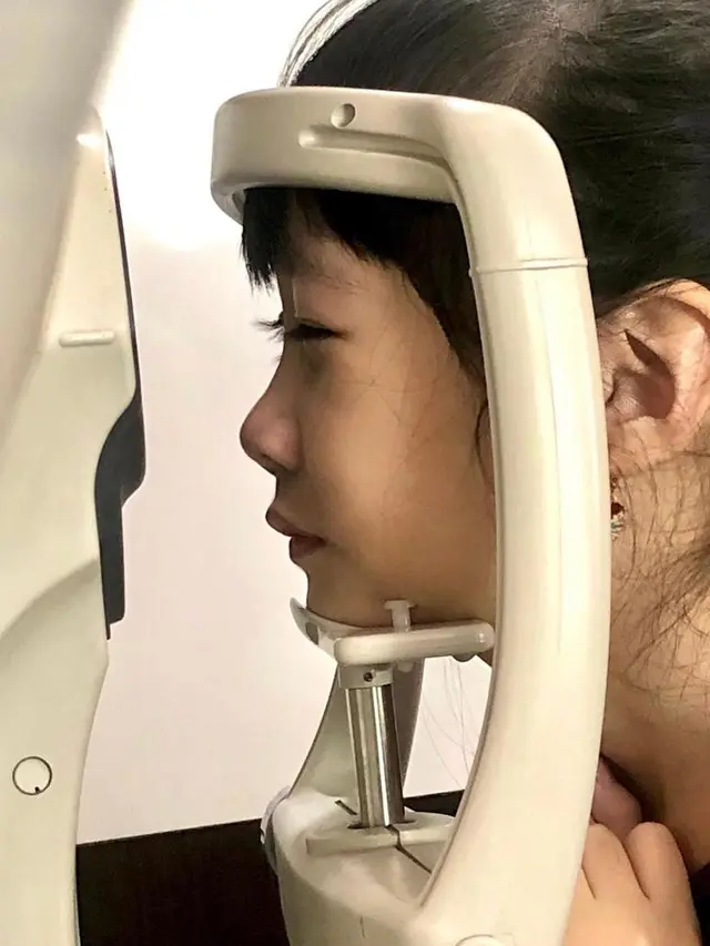 Mata minus pada anak