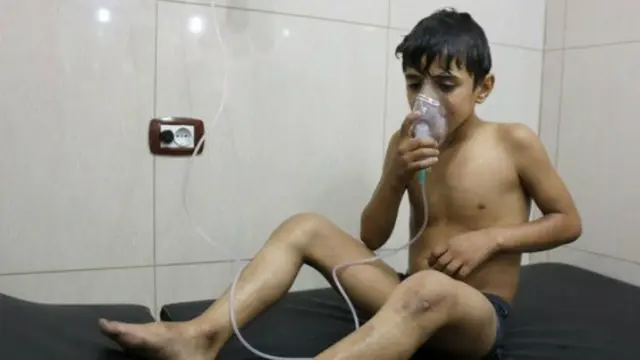 Seorang anak menggunakan masker oksigen akibat kesulitan bernapas