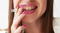 Cara Memutihkan Gigi pada Perokok