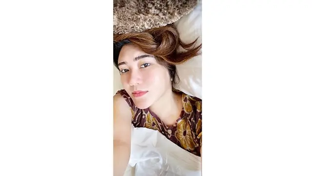 Unggah Foto Berjerawat, Ini 6 Potret Via Vallen Tampil Natural