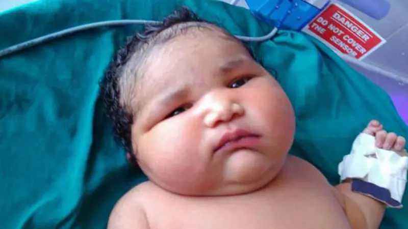 Bayi Raksasa Lahir dengan Bobot Nyaris 7 Kg