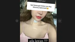 Lucinta Luna kembali memperlihatkan bagian hidung dan bibir, namun kini dari angle depan. (Foto: Instagram/ lucintaluna_manjalita)