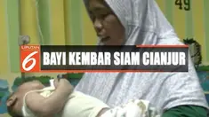 Kondisi fisik Fadli, salah satu dari bayi kembar ini melemah dan menderita batuk, flu, dan demam.