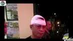 Luka di bagian kepala membuat Bripka Imam sempat dilarikan ke Rumah Sakit Tentara Wijayakusuma Purwokerto dan menjalani perawatan.