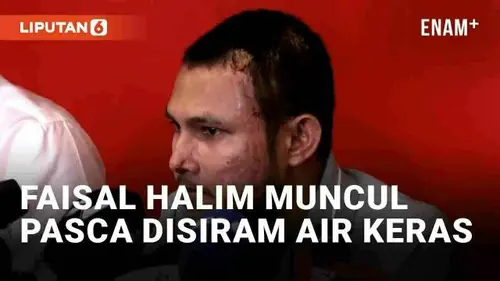 VIDEO: Bintang Timnas Malaysia Muncul ke Publik Pasca Disiram Air Keras, Siap Menepi Demi Keselamatan Keluarga