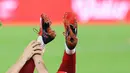 Cedera itu dialami Zijlstra ketika membela Timnas Indonesia menghadapi Timnas Saint Kitts dan Nevis dalam partai pertama FIFA Series 2026 di Stadion Utama Gelora Bung Karno (SUGBK), Jakarta Pusat, pada 27 Maret 2025. (Bola.com/M Iqbal Ichsan)