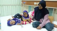 RS Hasan Sadikin Bandung Terima Pasien Kembar Siam Berkaki Tiga 