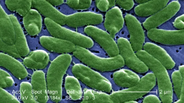 Vibrio vulnificus (CDC)