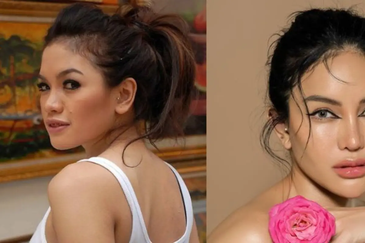 Habiskan Rp1M untuk Percantik Diri, Ini Potret Nikita Mirzani Before dan After Perawatan Wajah