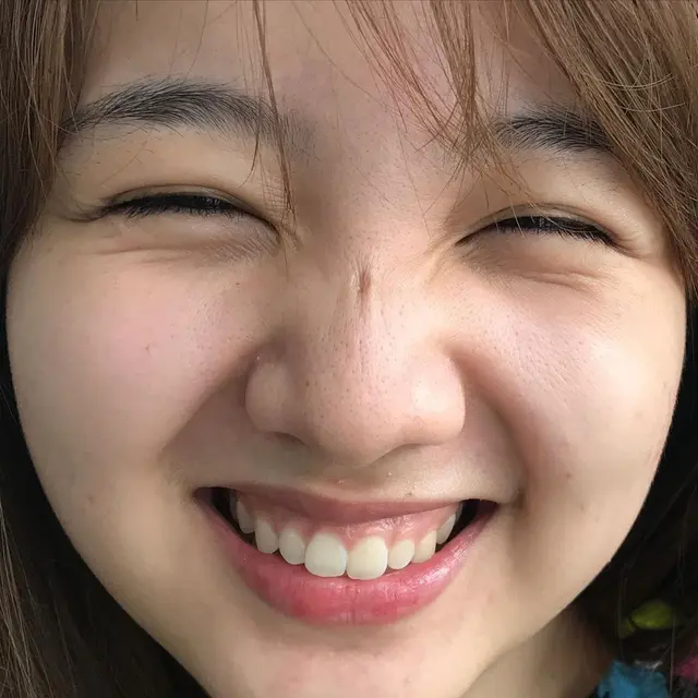 #ShowYourPores, Ubah Standar Kecantikan Usir Insecurity Pada Perempuan