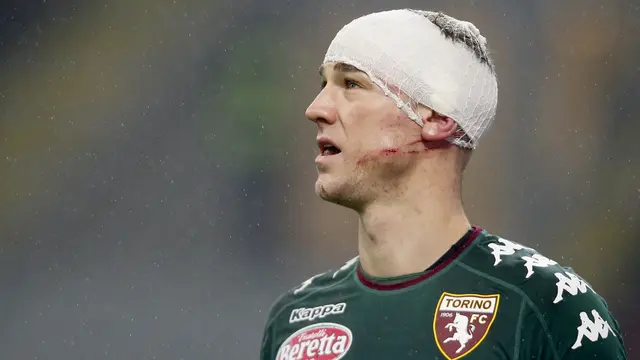 Joe Hart