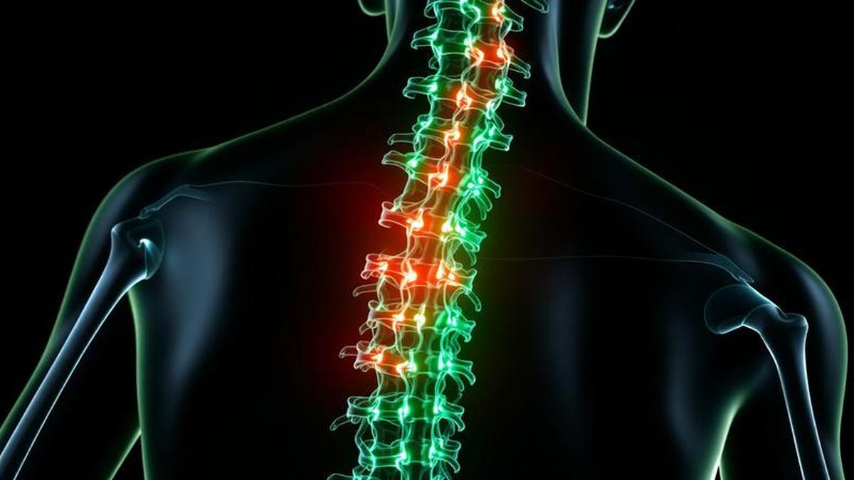 Cedera Sumsum Tulang Belakang Picu Disabilitas Fisik, Kenali Penyabab, Dampak, dan Penanganannya