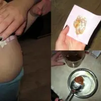 Batuk pada anak-anak bisa lenyap dengan cara alami ini, lho. Dijamin!