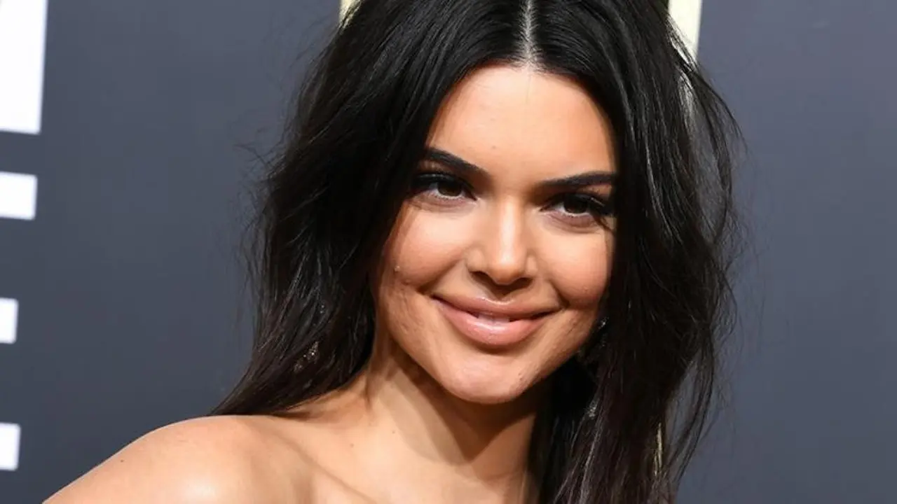 Nggak Mau Jerawatan Seperti Kendall Jenner? Atasi dengan Cara Ini