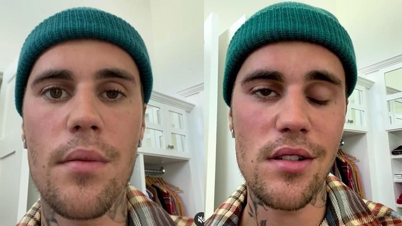 4 Fakta Justin Bieber Alami Kelumpuhan Wajah, Batalkan Beberapa Konser