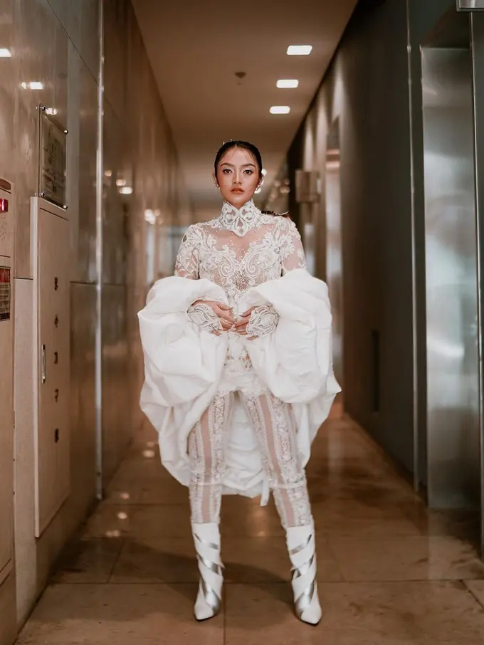 Kondisi Terbaru Siti Badriah Usai Jalani Operasi Pengangkatan Tumor Kelenjar Getah Bening