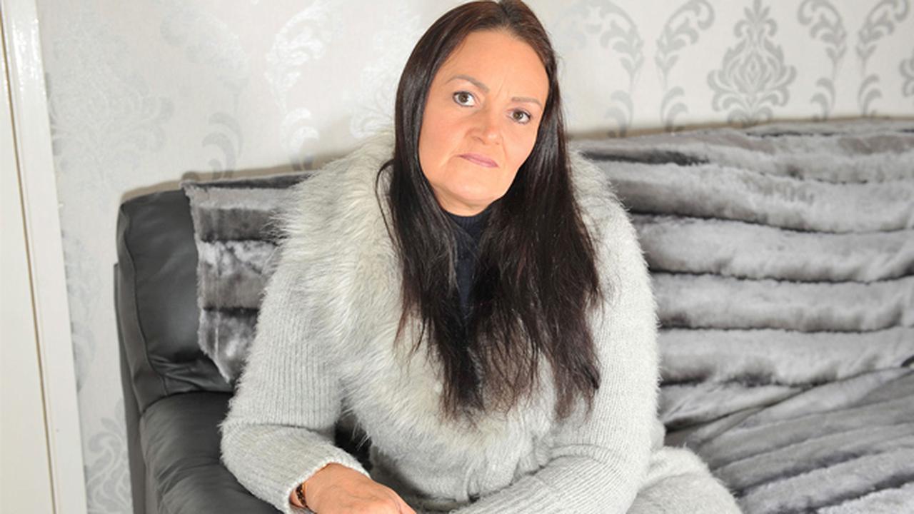 Ingin Tampil Cantik, Wanita Ini Malah Kehilangan Gigi