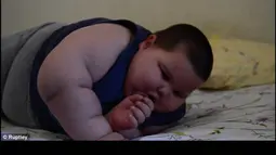 Misael yang lahir dengan bobot 2,9 kilogram diprediksi dokter mengalami sindrom Prader-Willi, yang memiliki kondisi kinetik  yakni merasa lapar dan terus bernafsu ingin makan. (Dailymail)  