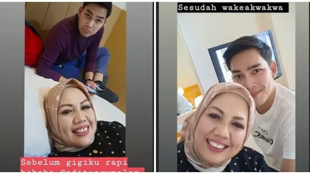 6 Potret Terbaru Ely Sugigi Setelah Lakukan Potong Gigi, Banjir Pujian