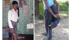 Ia sering mendapat hinaan dan cercaan dari masyarakat, yang menganggap apa yang telah ia alami itu adalah sebuah kutukan.