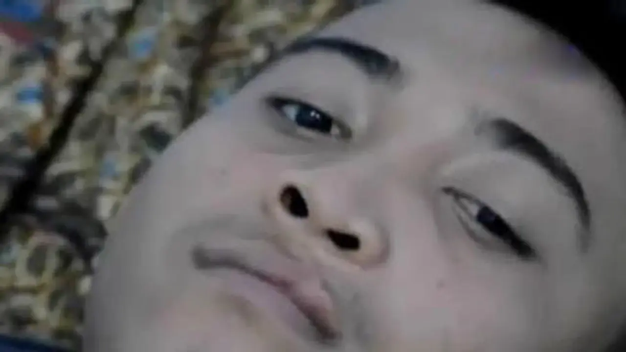 VIDEO: Pundi Amal SCTV Bantu Puluhan Warga Operasi Bibir Sumbing