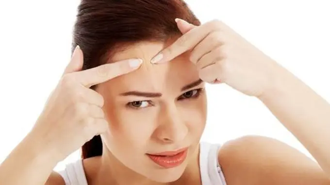 Jerawat/Copyright Shutterstock