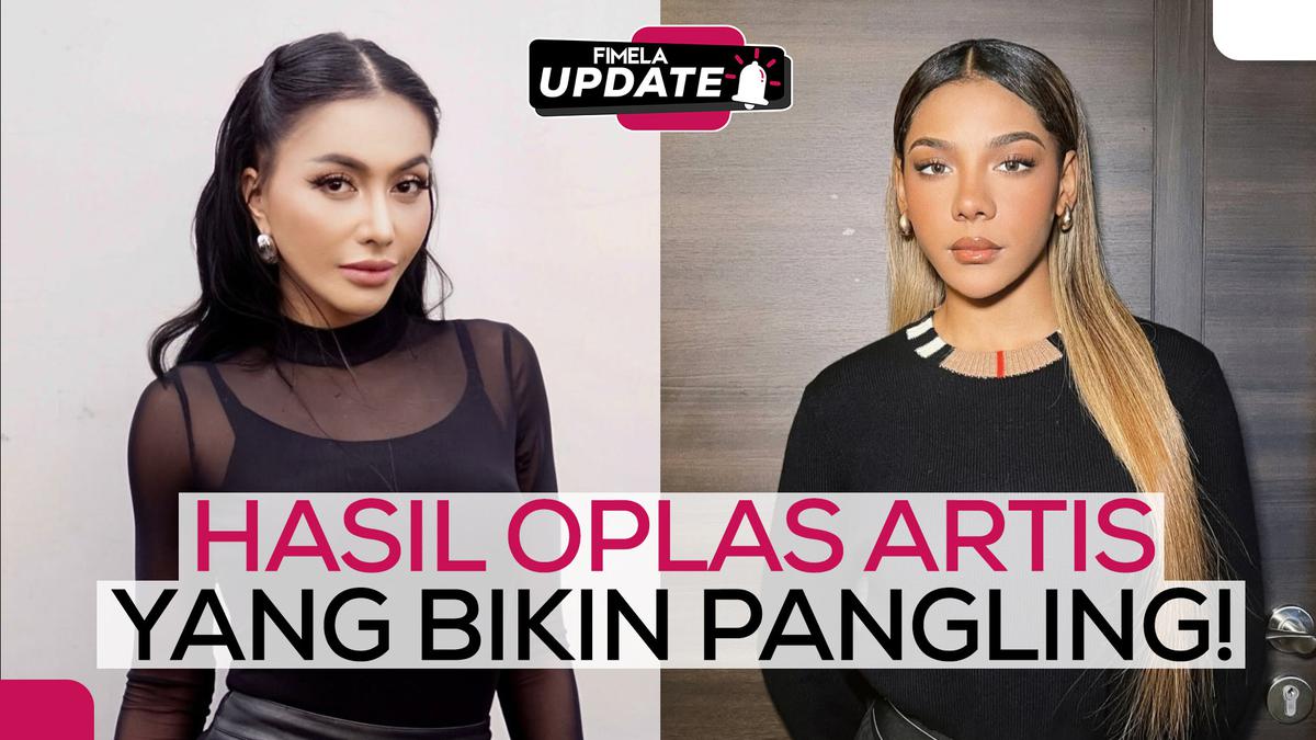 Dulu vs Sekarang: Transformasi Artis Indonesia Setelah Operasi Plastik, Bikin Melongo!