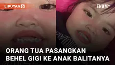 Seorang anak balita menggunakan behel gigi mengundang perhatian