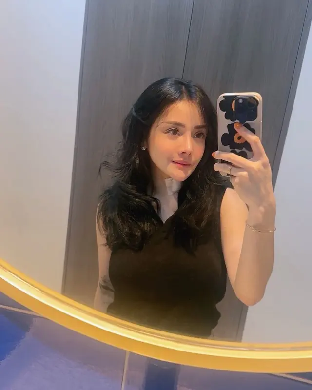 6 Potret terbaru Mawar AFI usai operasi plastik habiskan Rp521 Juta 