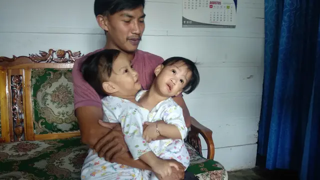 Jayasrin (25), ayah balita kembar siam, berhenti bekerja untuk menjaga bayinya.(Liputan6.com/Ahmad Akbar Fua)