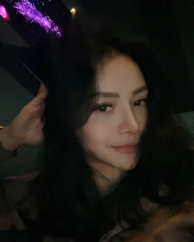 6 Potret terbaru Mawar AFI usai operasi plastik habiskan Rp521 Juta 