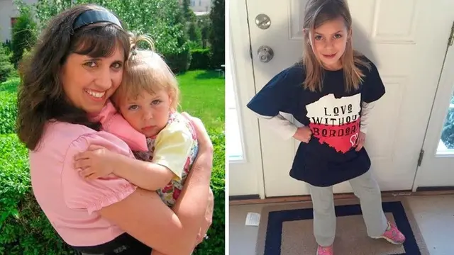 Before - After Adopsi