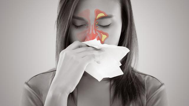 Ilustrasi Penyakit Sinusitis (Sumber: Istockphoto)