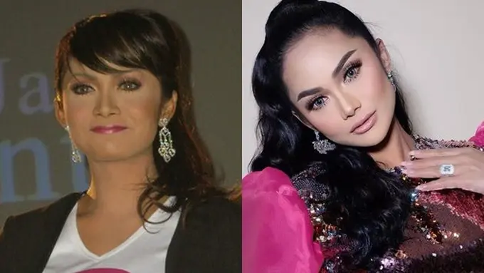 Potret Dulu Vs Kini Penyanyi Diduga Wajahnya Operasi Plastik, Perubahannya Drastis