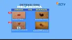 Waspada kanker kulit melanoma! Penyakit yang menyerang menantu Hatta Rajasa ini berpotensi mematikan. Kenali gejalanya dan lakukan pencegahan sejak dini, bagaimana?